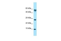GGNBP1 Rabbit anti-Human, Polyclonal, Novus Biologicals 100 &mu;g | Buy Online | Novus Biologicals | Fisher Scientific